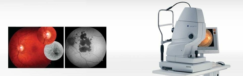 diagnostic visucam fundus camera ophthalmology clinic medic jukic